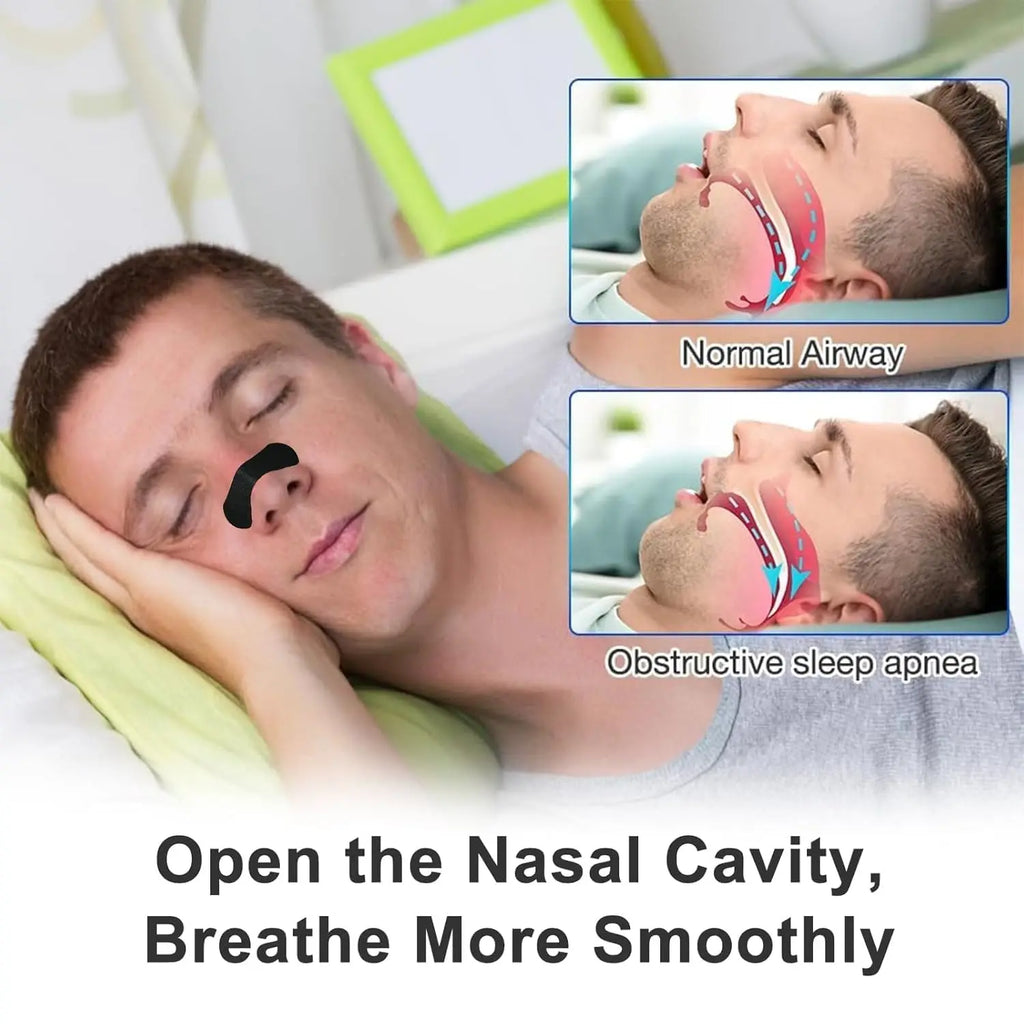 EliteSleep Pro – Premium Nose Strips für maximale Luftzufuhr & erholsame Nächte